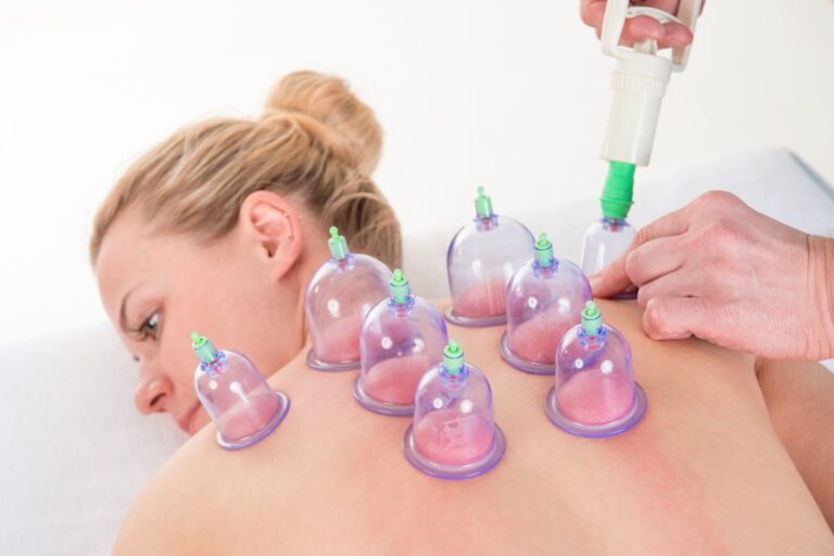 cupping therapy melbourne, cupping treatment melbourne