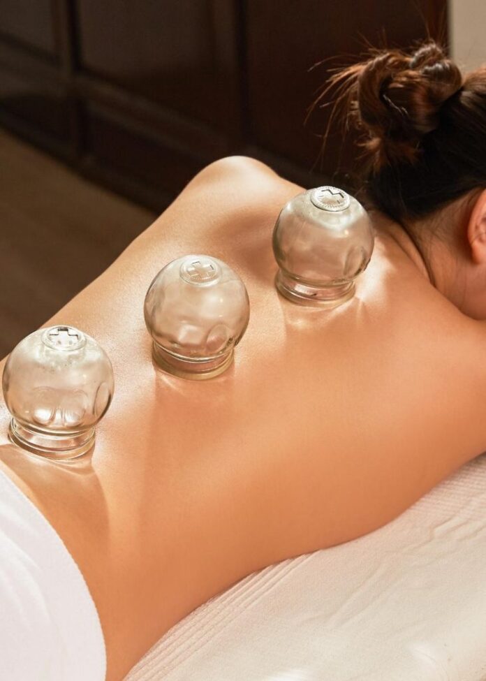 cupping-treatment-Melbourne