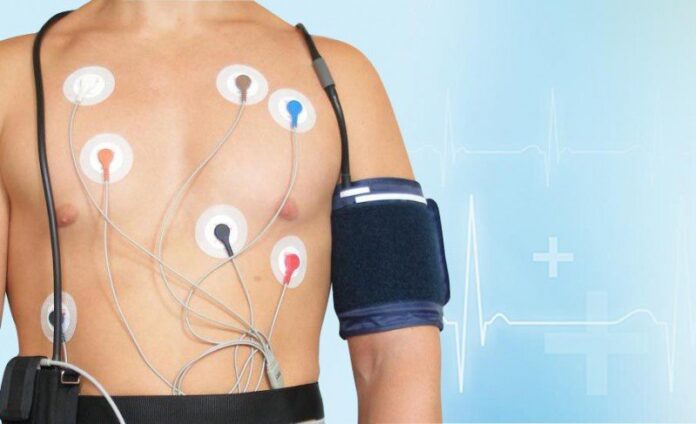 Holter monitor test Sydney